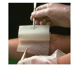 GARZA MEDICATA BACTIGRAS CON CLOREXIDINA ACETATO 0,5% 15X20CM 10 PEZZI - Farmacia Dott. Pasquale Russo