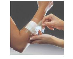 FILM ADESIVO IN POLIURETANO OPSITE FLEXIFIX IN ROTOLO TRASPARENTE IMPERMEABILE PER FISSAGGIO DI MEDICAZIONI E CATETERI LARGHEZZA 15 CM LUNGHEZZA 10 M 1 PEZZO - Farmacia Dott. Pasquale Russo